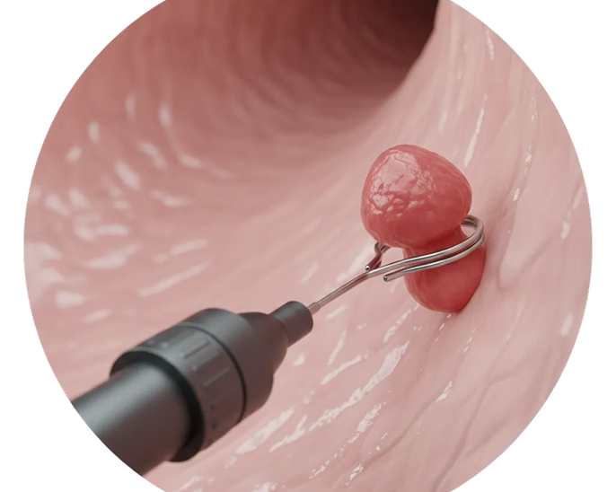 발견 따로, 수술 따로? NO