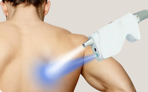 신장 분사 치료