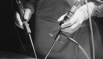 양방향
척추내시경수술