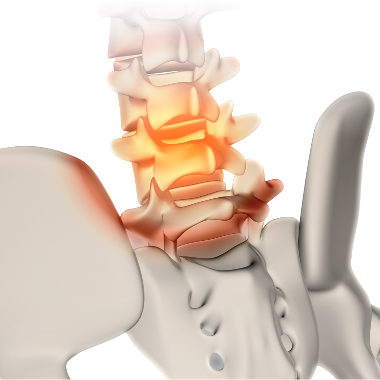 스파인패스 히어로